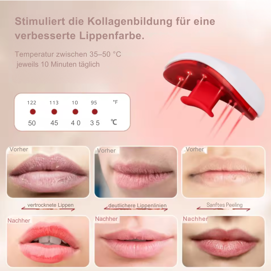 LUMÉRA - Lip Plumper Gerät